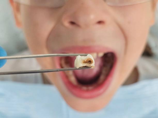 Best Emergency Root Canal Therapy in Loop, PA